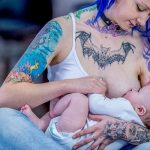 Can You Get Laser Tattoo Removal While Breastfeeding