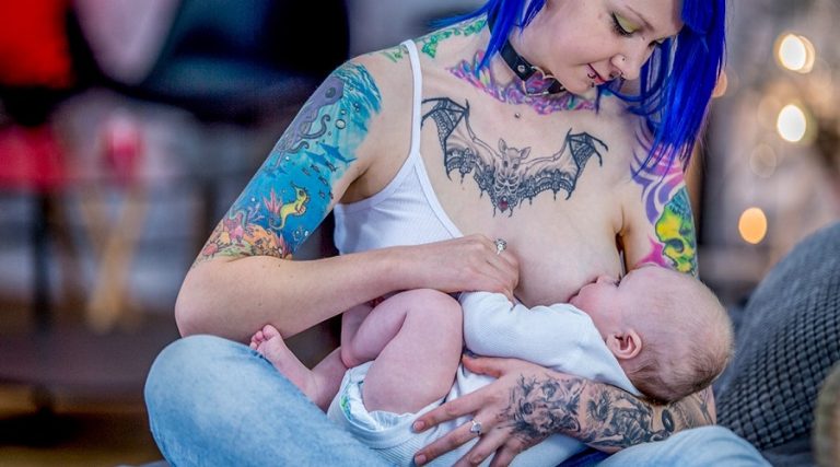 Can You Get Laser Tattoo Removal While Breastfeeding