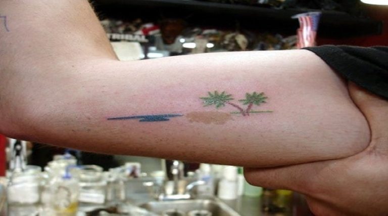 Can You Tattoo Over A Birthmark
