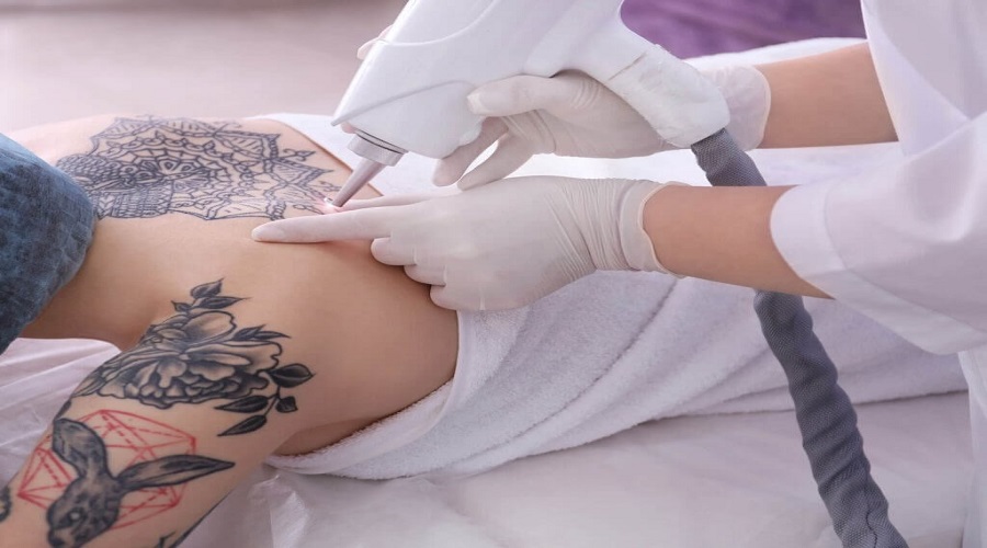 How To Become A Laser Tattoo Removal Technician?
