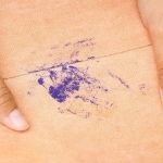 How To Get Tattoo Ink Out Of Clothes