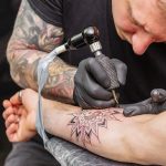 Can I Get A Tattoo 2 Weeks Before Surgery