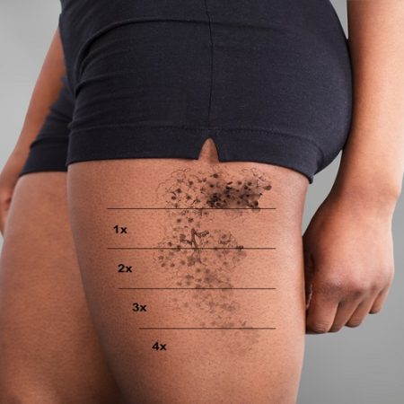 Can You Add Color To A Black Tattoo?