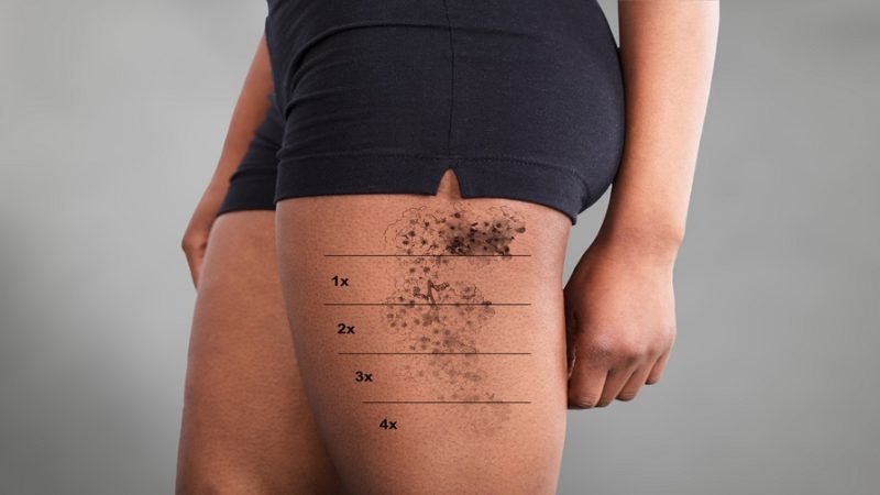 Can You Add Color To A Black Tattoo?