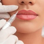 How To Remove Lip Tattoo